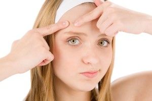 Acne tratamiento natural